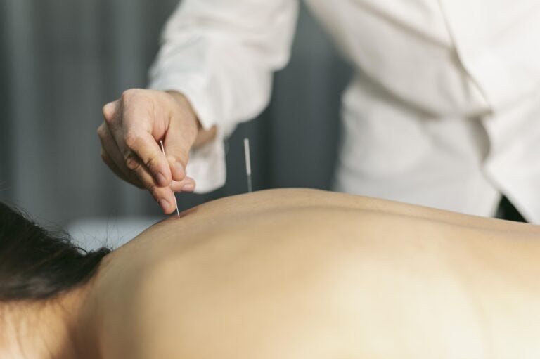 Dry Needling Physio Hausbesuche